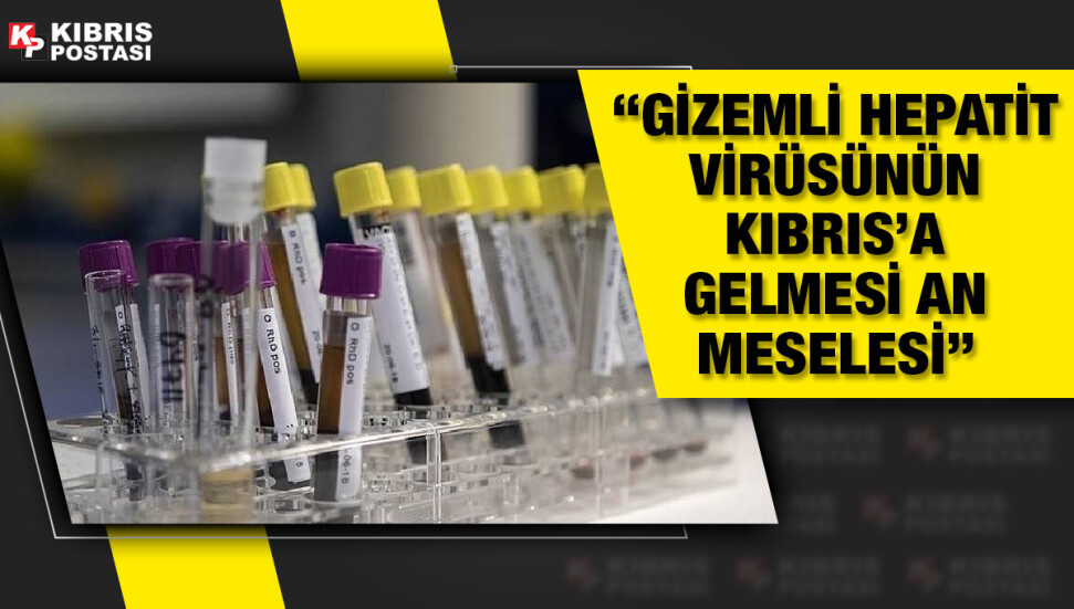 Rum basını: “Gizemli hepatit virüsünün Kıbrıs’a gelmesi an meselesi”