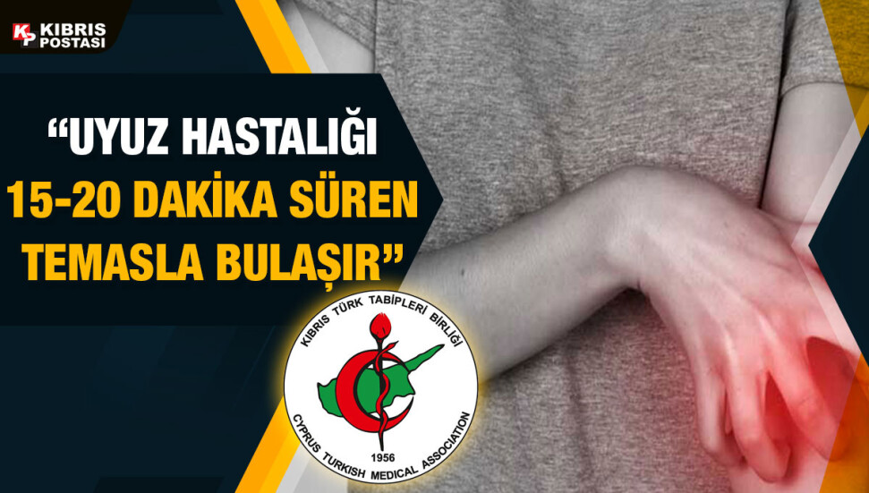 Tabipleri Birliği: Uyuz hastalığında artış yaşanıyor