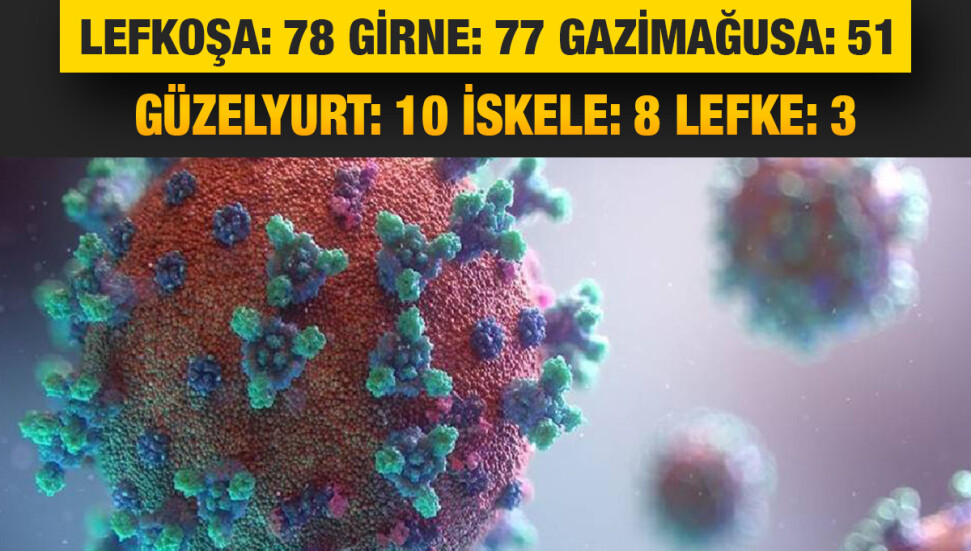 KKTC’de 297 yeni pozitif vaka belirlendi