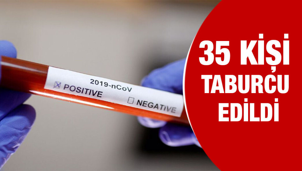 Son 24 saatte  7 bin 698 test yapıldı, 68 pozitif vakaya rastlandı!