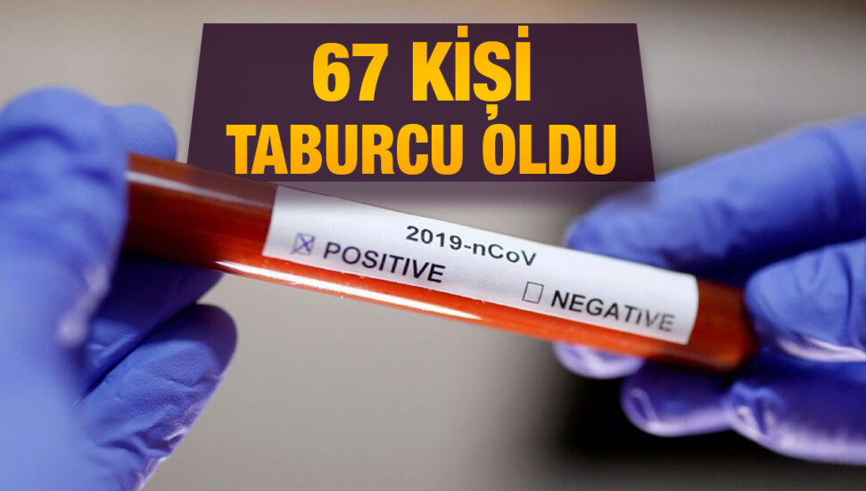 Son 24 saatte 8 bin 286 test, 54 yeni vaka!