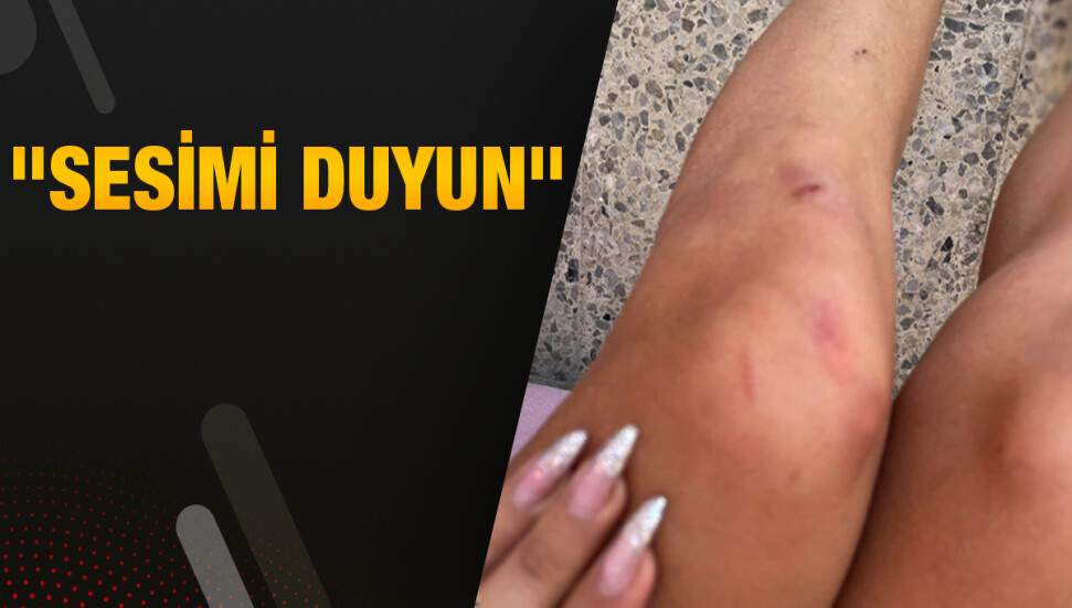 Günsel Angela: Polis tarafından sözlü ve fiziksel şiddete uğradım!