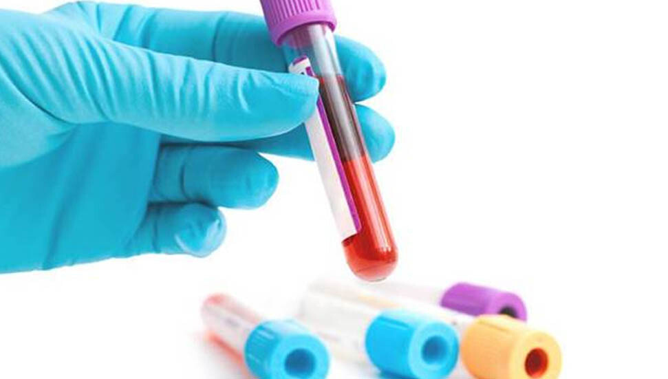 Erken tanıda devrim: Galleri testi 50’den fazla kanser türünü yüksek doğrulukla tespit etti