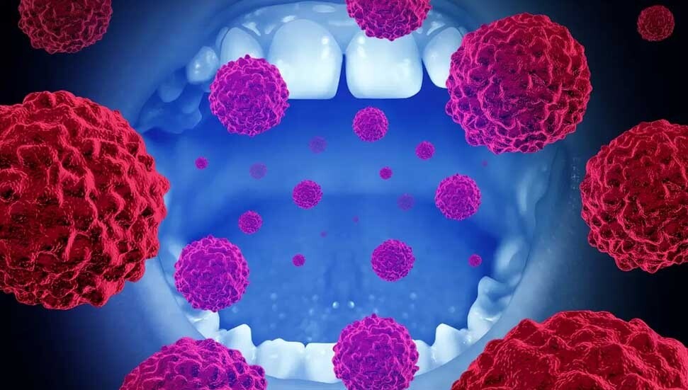 Güney Kıbrıs’ta son 10 yılda toplam 550 ağız kanseri vakası kayda geçirildi