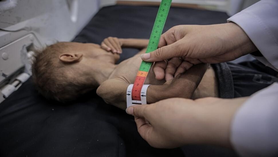 Gazze'de son 24 saatte 1'i çocuk 6 kişi daha açlıktan hayatını kaybetti