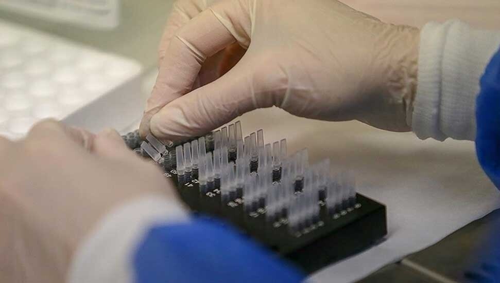 Altı parmaklı çocukların doğmasına yol açan bir bozukluk belirlendi