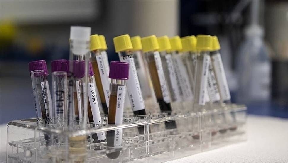 Birleşik Krallık'ta 'gizemli hepatit' virüsü bulaşan 8 çocuğa karaciğer nakli yapıldı