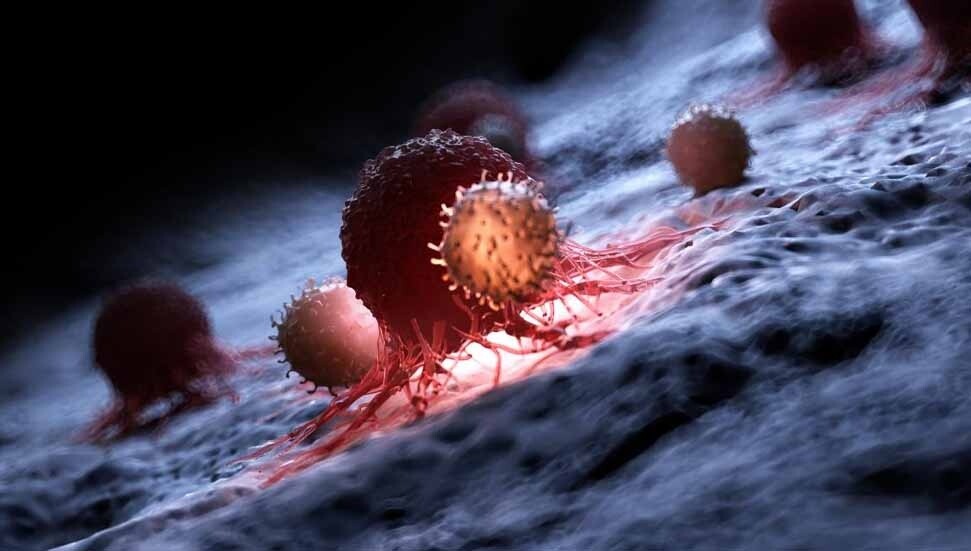 Güney Kıbrıs'ta çocukluk çağı kanseri için uluslararası etkinlik düzenleniyor