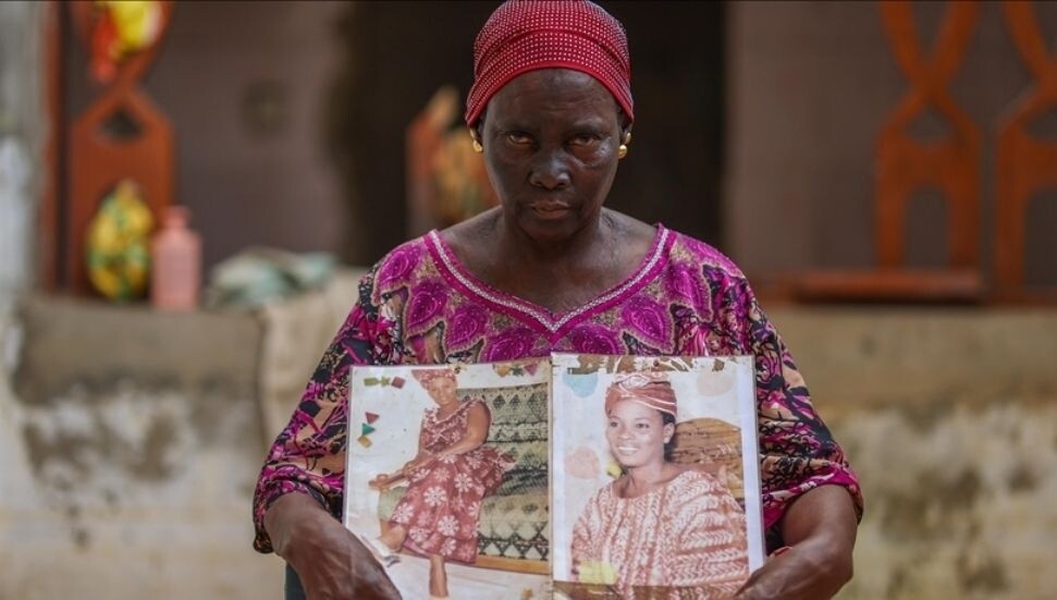 Afrika'da "beyazlaşma" ürünleri toplumsal sağlığı riske atıyor