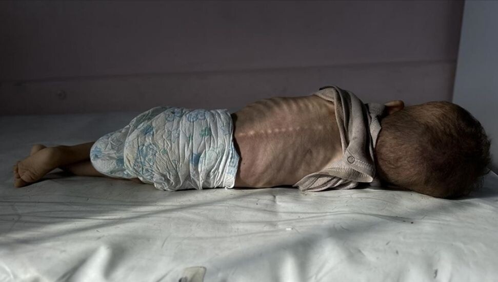 UNICEF: Gazze’de her 5 çocuktan 1’i akut yetersiz beslenme yaşıyor