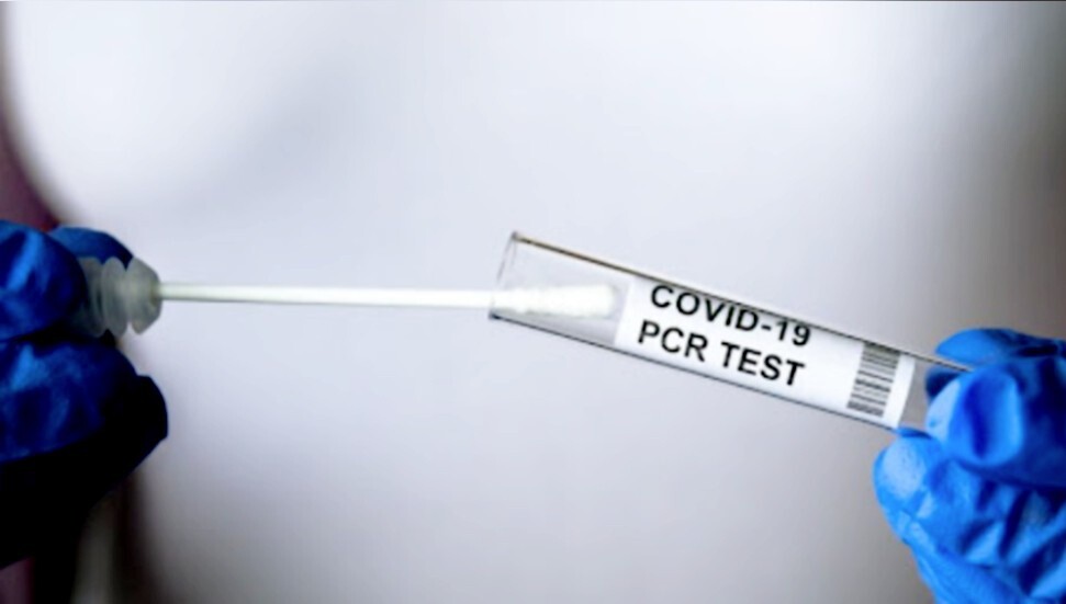 56 yaşındaki lösemi hastasının 84. koronavirüs testi de pozitif çıktı