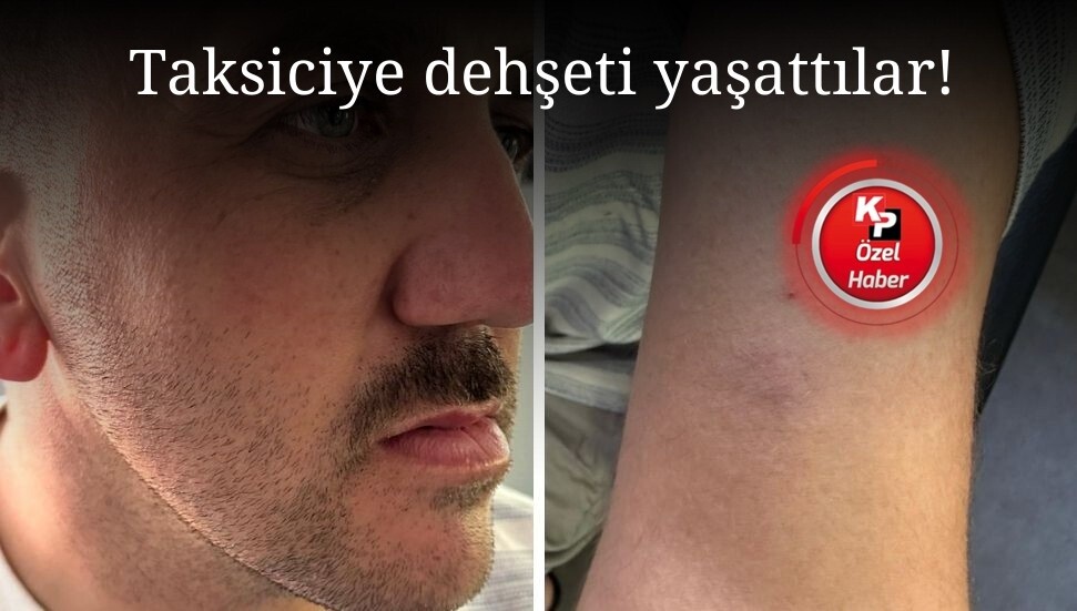 Kuzey Kıbrıs’ta taksiciye dehşeti yaşattılar, ellerini kollarını sallayarak ülkeden ayrıldılar!