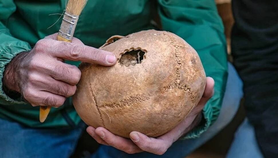Van’da 3 bin 200 yıl öncesine ait beyin ameliyatı izine rastlandı