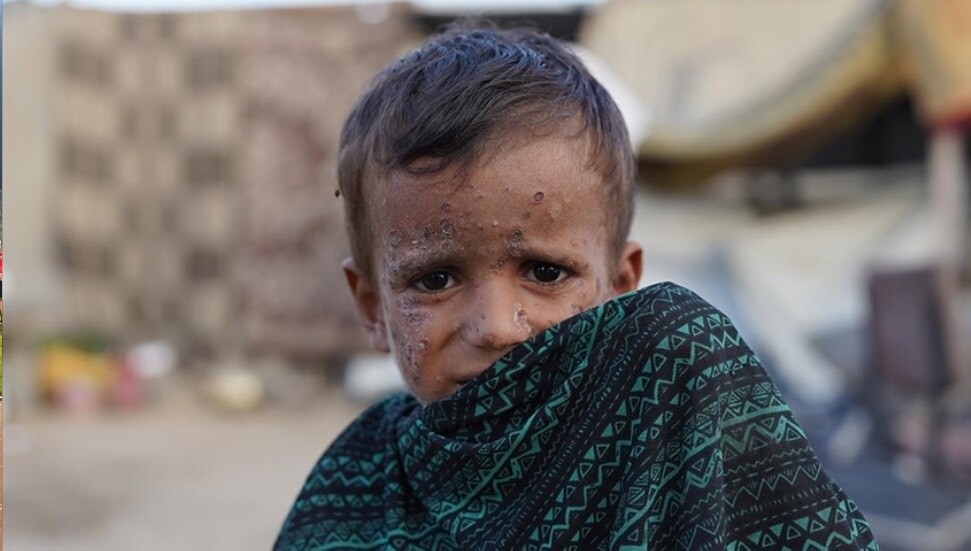 UNICEF: Yeni yıl Gazze'deki çocuklar için daha fazla ölüm ve acı getirdi