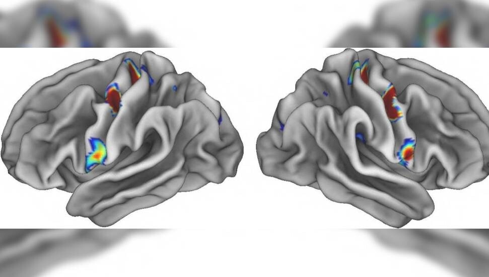 Timus bezinin kanserle mücadeledeki rolü