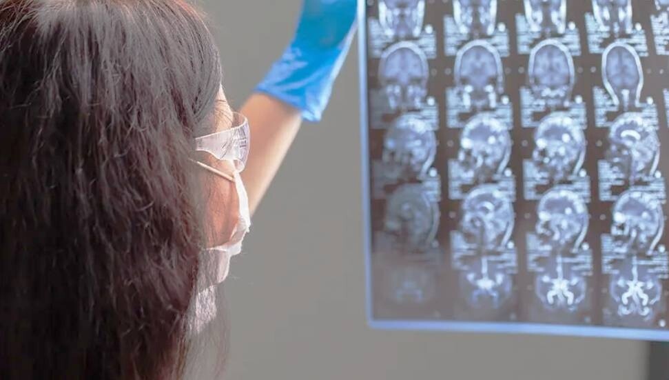 DSÖ: Her yıl nörolojik rahatsızlıklar nedeniyle 11 milyon can kaybı yaşandı