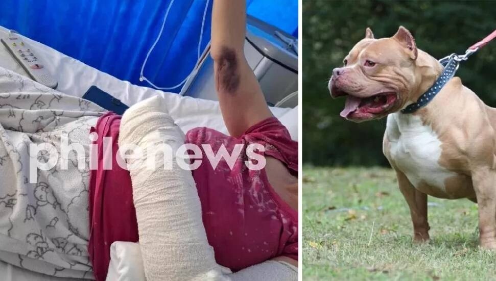 Ülkede barındırılması yasak pitbul cinsi bir köpek tahsildara saldırdı
