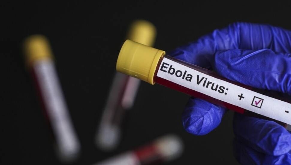 Bulaşıcı Hastalıklar Üst Komitesi'nden "Ebola"ya karşı yeni önlemler: Numuneler Türkiye’ye gönderilecek