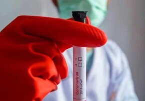 Türkiye'de 1716 yeni vaka!