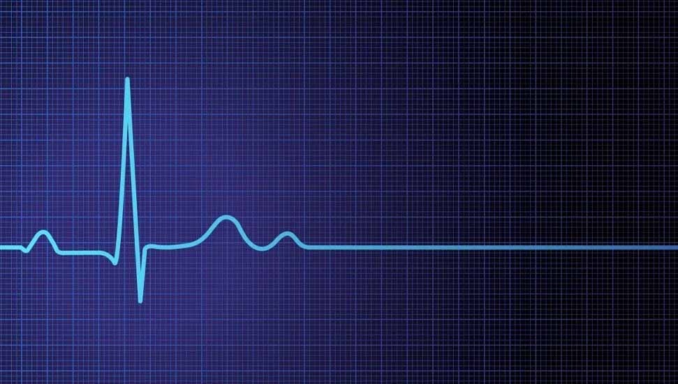 Siddiga Erdemlier'in ölüm nedeni kalp hastalıkları olarak belirlendi