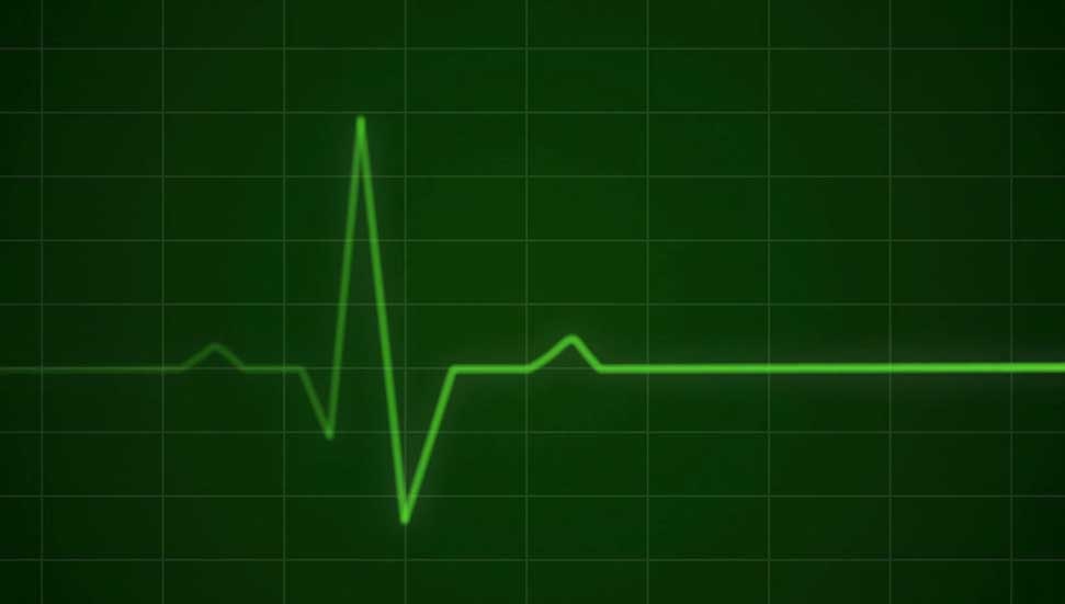 21 yaşındaki Buse Kara’nın ölüm sebebi “akciğer enfeksiyonu ve pulmoner emboli”