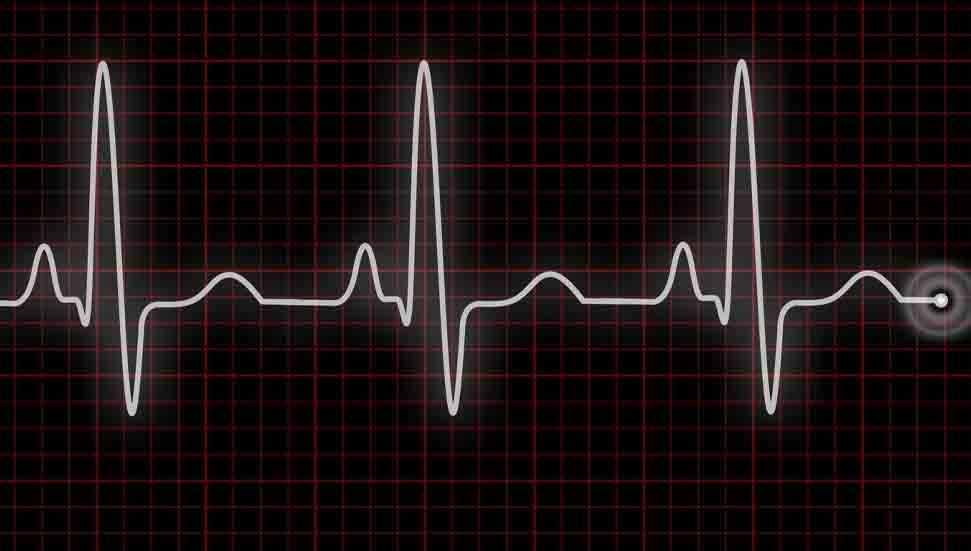 56 yaşındaki Hamdi Uluışık’ın ölüm sebebi “kalp damar hastalığı”